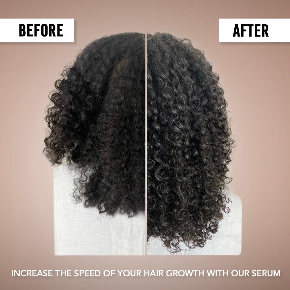 Hair Growth Serum [3 packs]